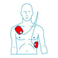 Electrodes & Batteries